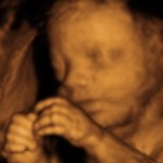 3d-ultrasound-27-weeks-3-days